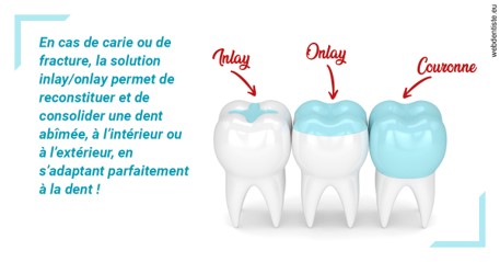 https://selarl-cabinet-docteur-monthean.chirurgiens-dentistes.fr/L'INLAY ou l'ONLAY