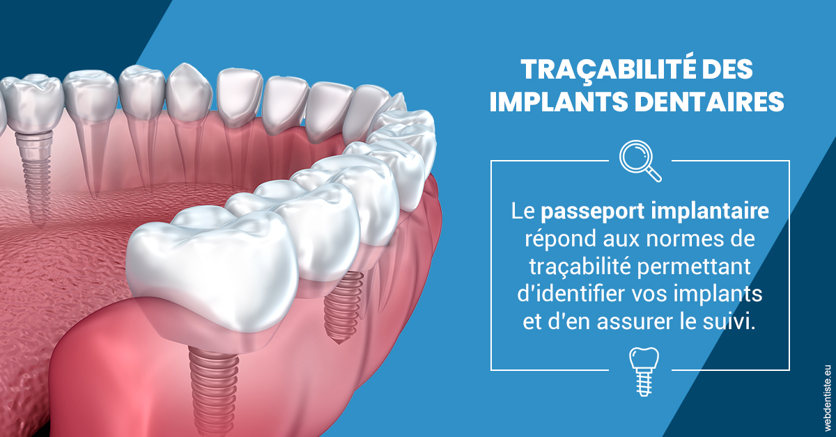 https://selarl-cabinet-docteur-monthean.chirurgiens-dentistes.fr/T2 2023 - Traçabilité des implants 1