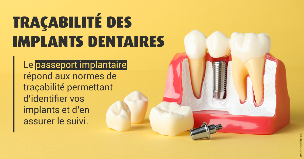 https://selarl-cabinet-docteur-monthean.chirurgiens-dentistes.fr/T2 2023 - Traçabilité des implants 2