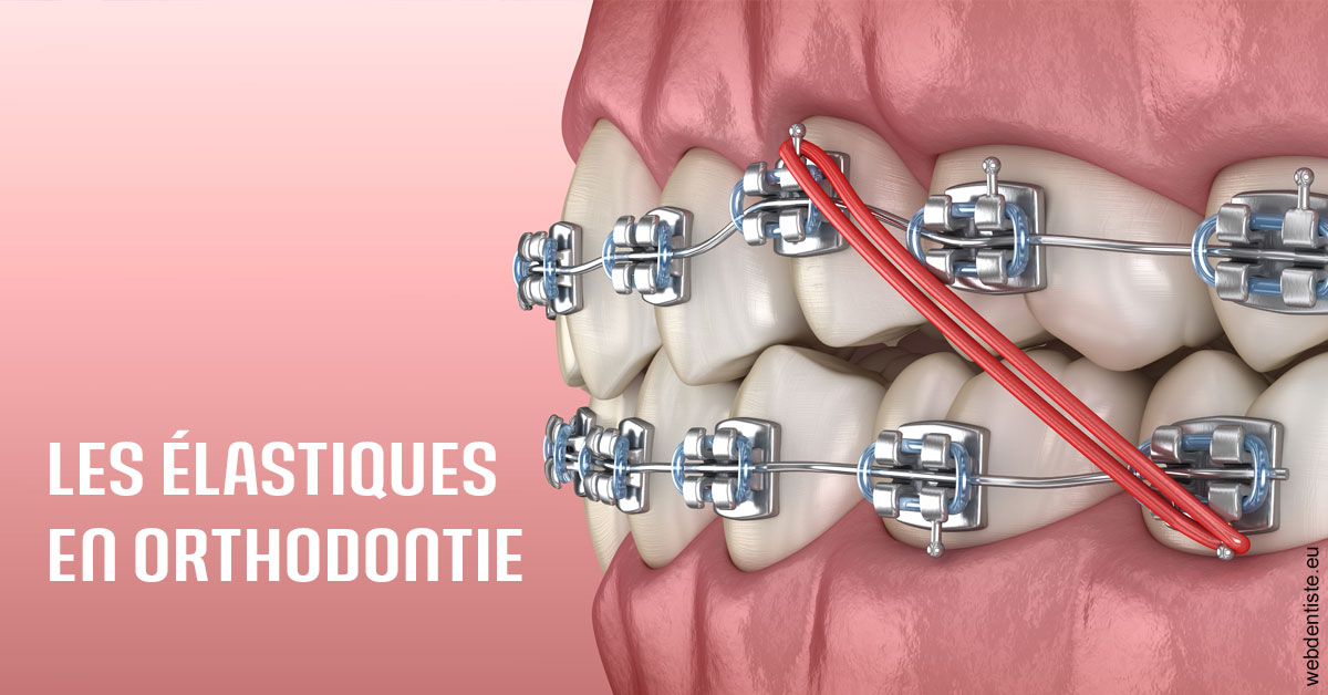 https://selarl-cabinet-docteur-monthean.chirurgiens-dentistes.fr/Elastiques orthodontie 2