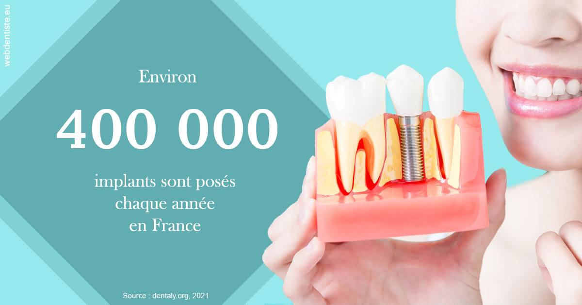https://selarl-cabinet-docteur-monthean.chirurgiens-dentistes.fr/Pose d'implants en France 2