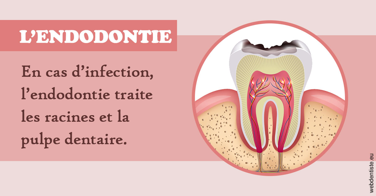 https://selarl-cabinet-docteur-monthean.chirurgiens-dentistes.fr/L'endodontie 2
